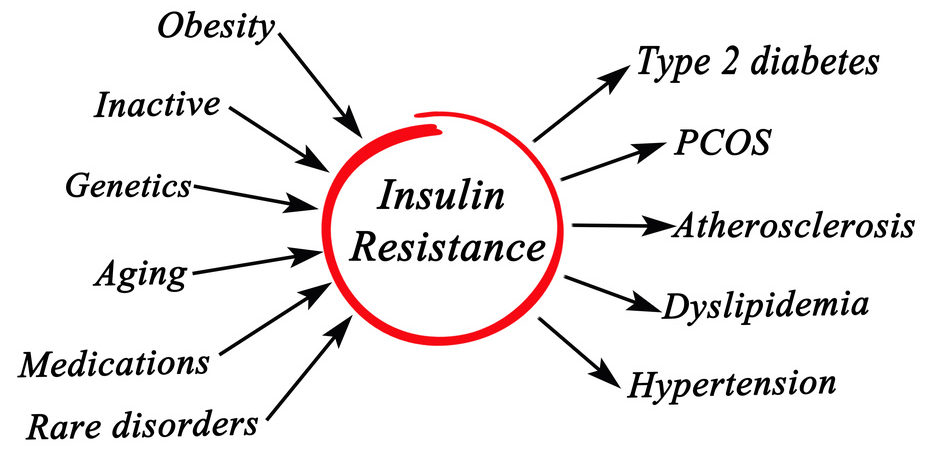 Insulin sensitivity and PCOS