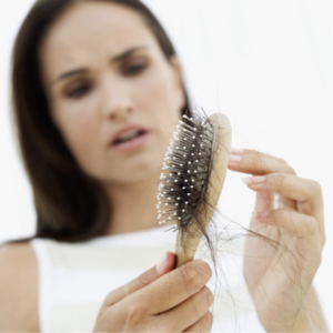 PCOS hair loss 