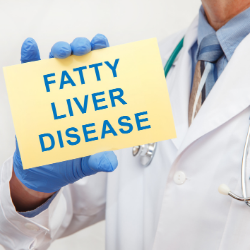 PCOS and fatty liver