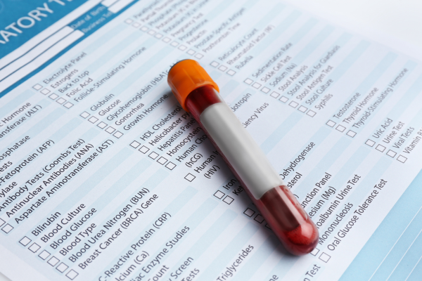 vial of blood taken for heart health workup